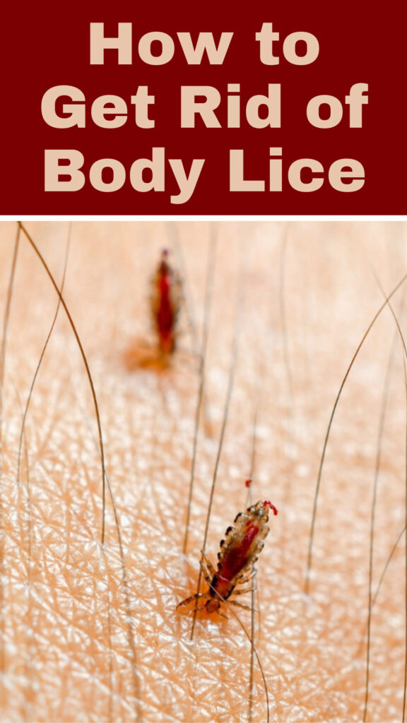 Get Rid of Body Lice