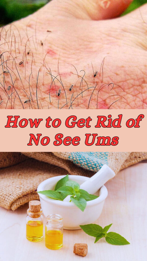 Get Rid of No See Ums