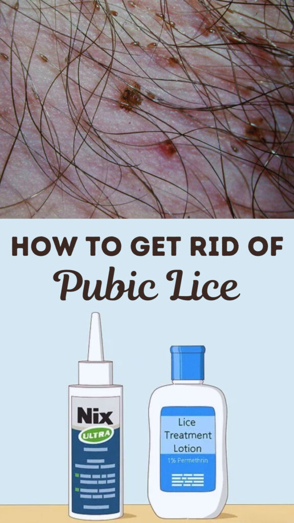 Get Rid of Pubic Lice