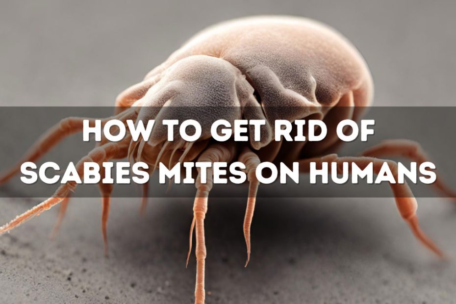 How to Get Rid of Scabies Mites on Humans